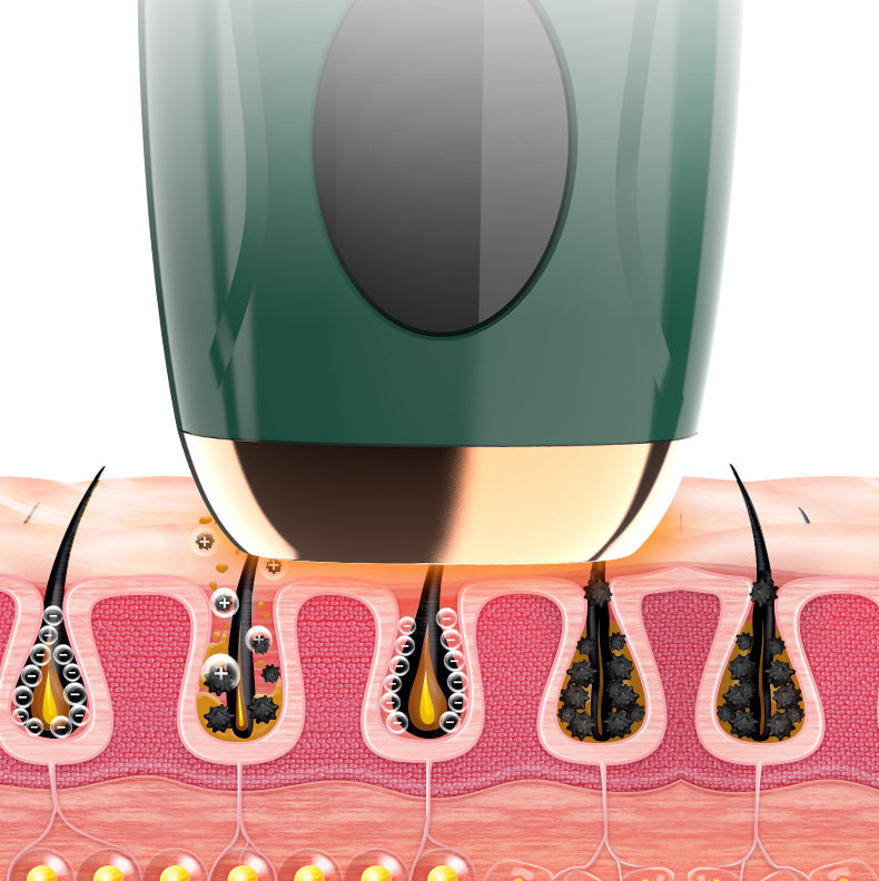 IPL Photon Hair removal device