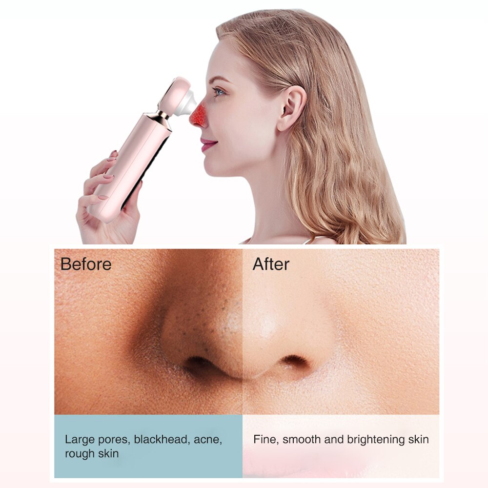 Visual Blackhead Vacuum Remover with Magnifier LED Light Face Pore Cleaner Acne Black Electric Blackhead Removal Nose Cleaner