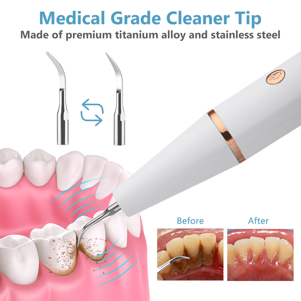 Electric Sonic Dental Calculus Scaler Oral Teeth Irrigator Tartar Calculus Remover Plaque Stains Cleaner Remova Teeth Whitening