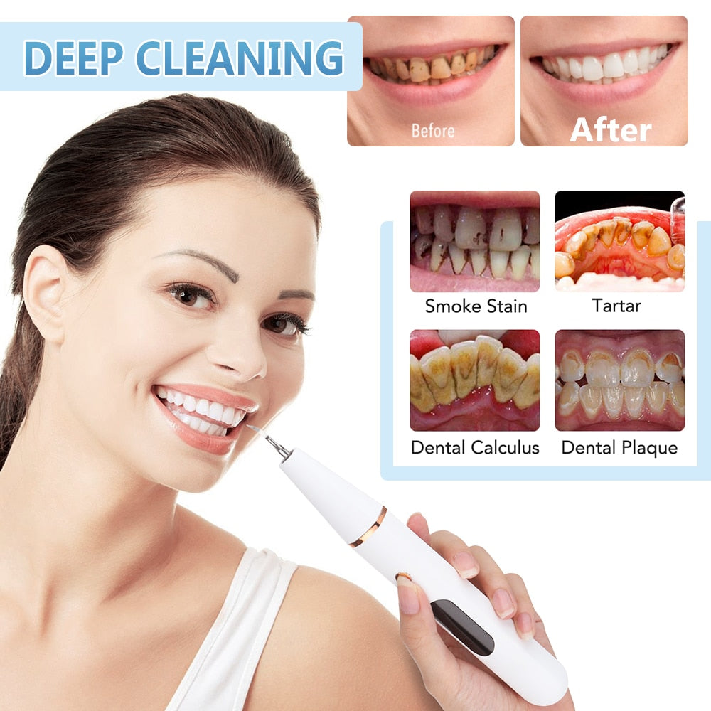Electric Sonic Dental Calculus Scaler Oral Teeth Irrigator Tartar Calculus Remover Plaque Stains Cleaner Remova Teeth Whitening
